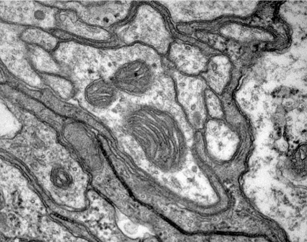 The Scream - Katy Stubbs